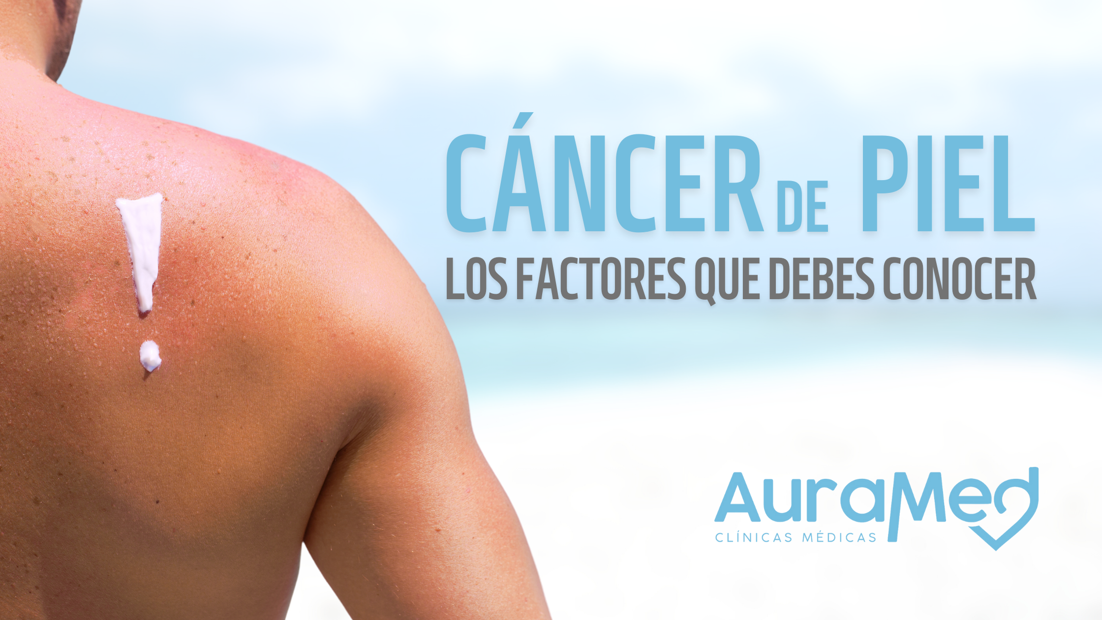 Auraned como prevenir cancer de piel